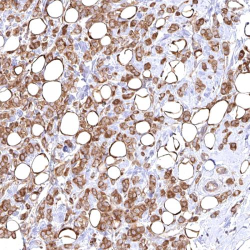 Acetyl-CoA Carboxylase 1（ACC）Antibody Reagent for Immunohistochemistry