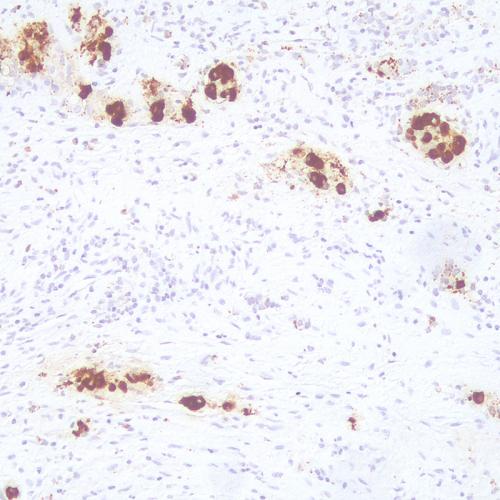 ACTH Antibody Reagent for Immunohistochemistry