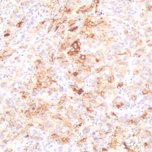 AFP Antibody Reagent for Immunohistochemistry