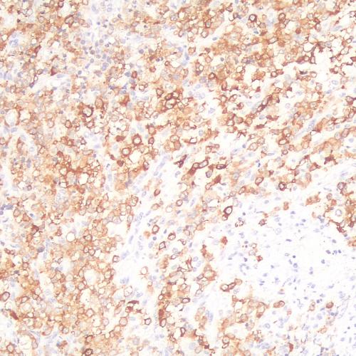 ALK/p80 Antibody Reagent for Immunohistochemistry