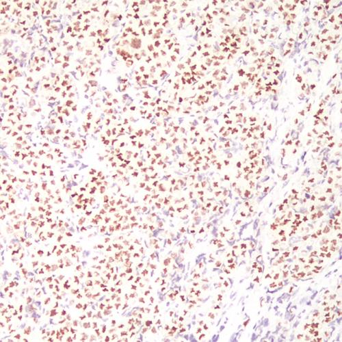 GATA-3 Antibody Reagent for Immunohistochemistry