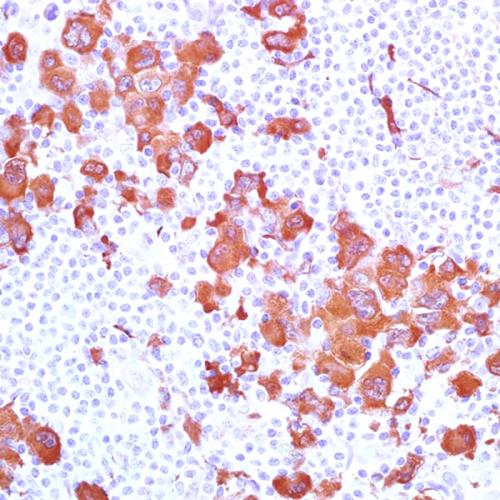 Fascin Antibody Reagent for Immunohistochemistry