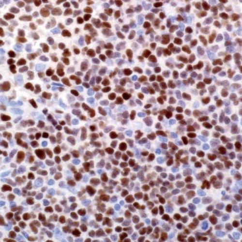 SOX-11 Antibody Reagent for Immunohistochemistry