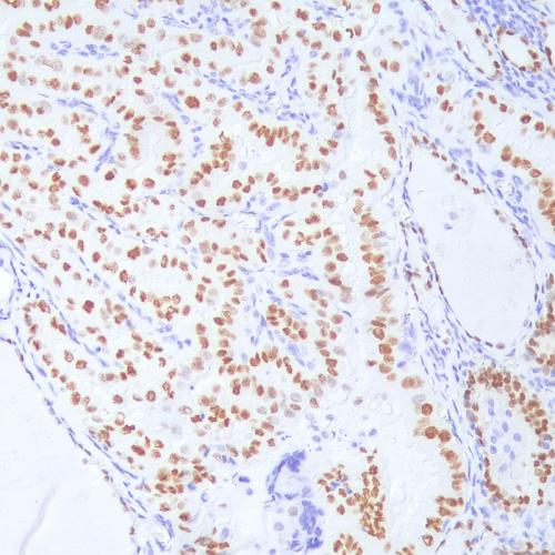 TTF-1 Antibody Reagent for Immunohistochemistry