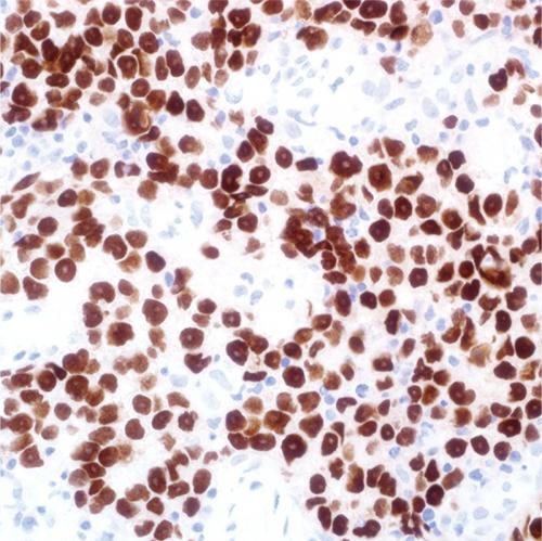 SALL4 Antibody Reagent for Immunohistochemistry