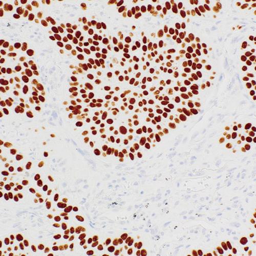 P40 Antibody Reagent for Immunohistochemistry