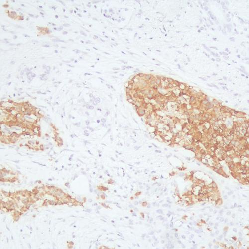 Synaptophysin Antibody Reagent for Immunohistochemistry