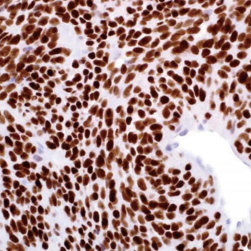 TLE1 Antibody Reagent for Immunohistochemistry