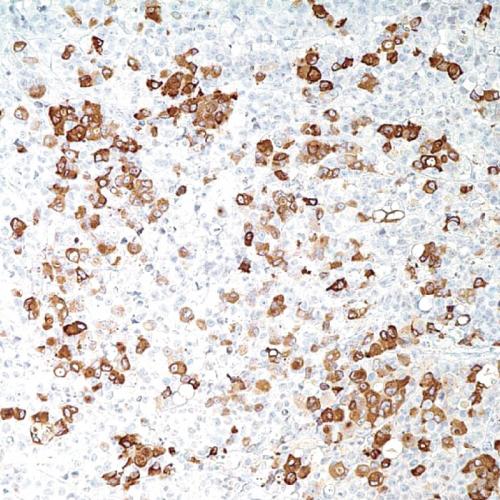 Mammaglobin Antibody Reagent for Immunohistochemistry