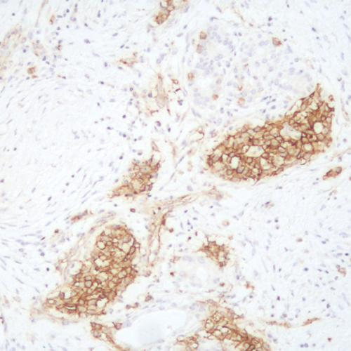 SSTR2 Antibody Reagent for Immunohistochemistry