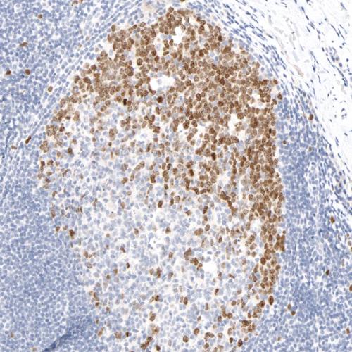 Survivin Antibody Reagent for Immunohistochemistry
