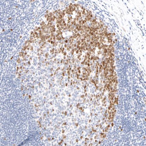 Survivin Antibody Reagent for Immunohistochemistry