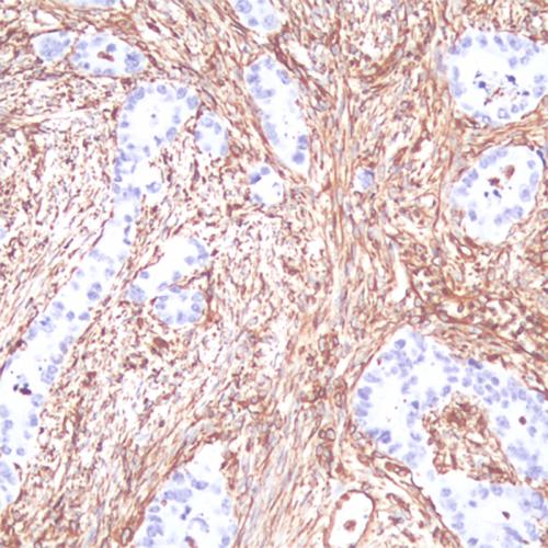 Vimentin Antibody Reagent for Immunohistochemistry