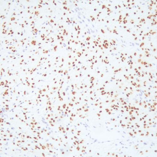 SOX-10 Antibody Reagent for Immunohistochemistry