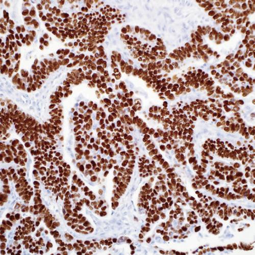 P53 Antibody Reagent for Immunohistochemistry