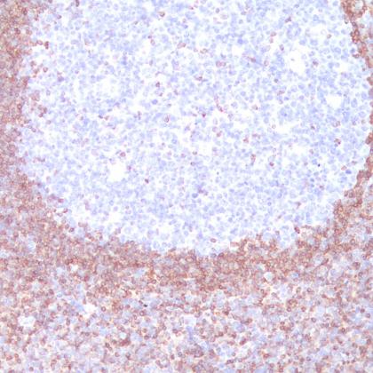 bcl-2 Antibody Reagent for Immunohistochemistry,Primary Antibodies ...