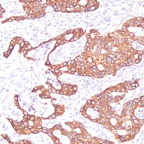 Ber-EP4 Antibody Reagent for Immunohistochemistry