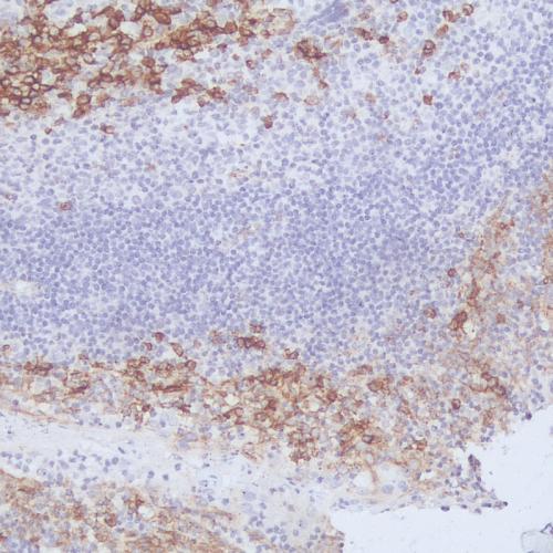 CD138 Antibody Reagent for Immunohistochemistry