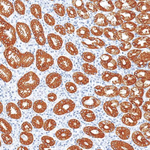 CK8 Antibody Reagent for Immunohistochemistry