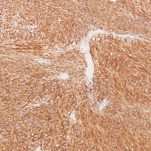 CD117 Antibody Reagent for Immunohistochemistry