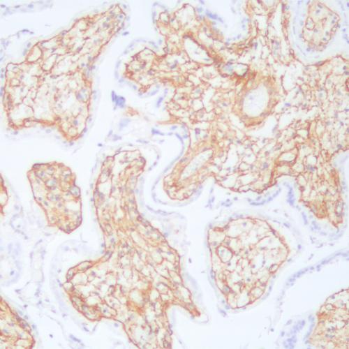 Collagen Type IV Antibody Reagent for Immunohistochemistry