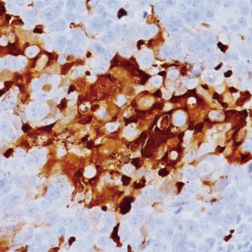 HIF-1α Antibody Reagent for Immunohistochemistry