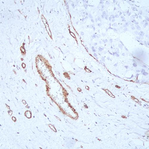 CD146 Antibody Reagent for Immunohistochemistry