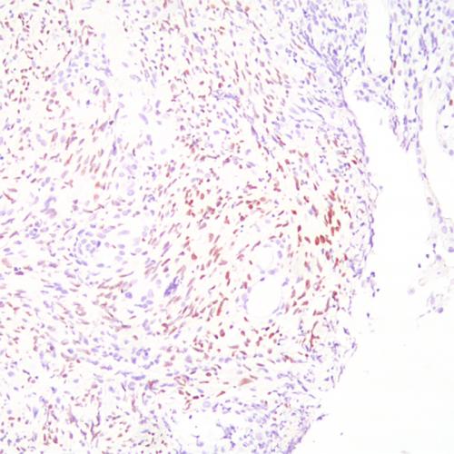 HHV-8 Antibody Reagent for Immunohistochemistry