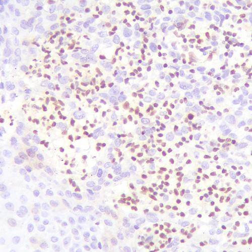 FLI-1 Antibody Reagent for Immunohistochemistry