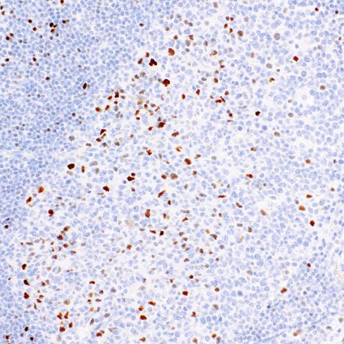 c-MYC Antibody Reagent for Immunohistochemistry