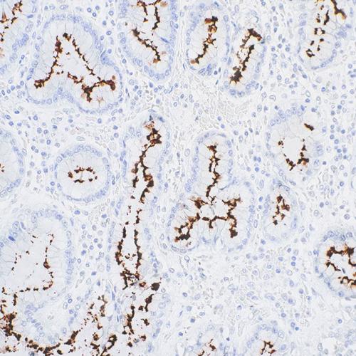 Helicobacter Pylori Antibody reagent
