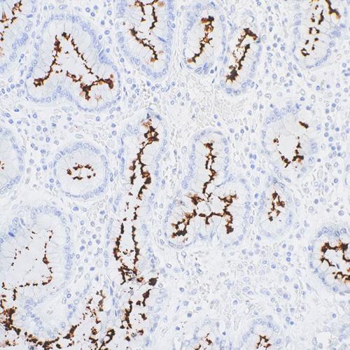 Helicobacter Pylori Antibody reagent--Primary Antibody