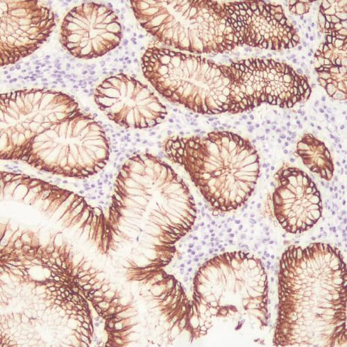 Claudin 18.2 Antibody Reagent for Immunohistochemistry