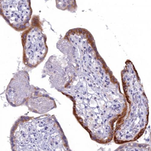 IHC Antibody -- Human Chorionic Gonadotropin