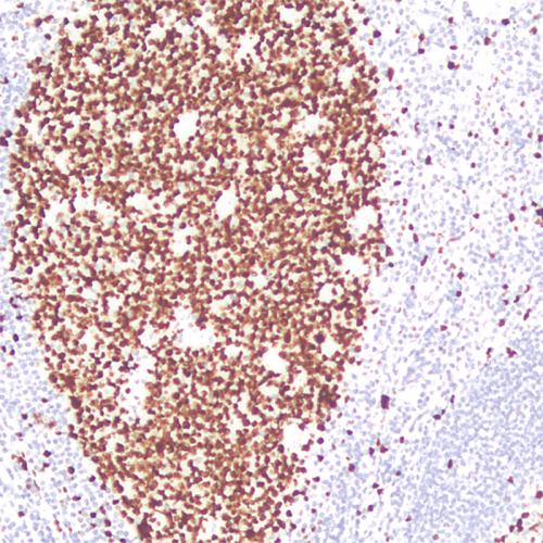 Ki-67 Antibody Reagent for Immunohistochemistry