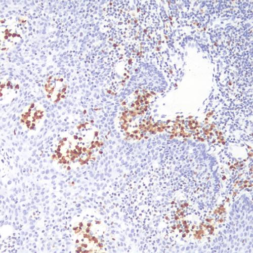 MUM1 Antibody Reagent for Immunohistochemistry