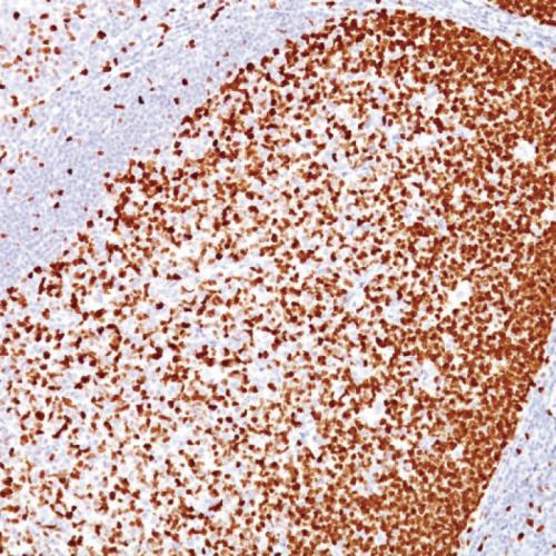 PCNA Antibody Reagent for Immunohistochemistry